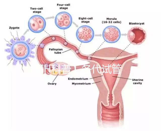 【FIH科普】各代試管嬰兒技術的比較