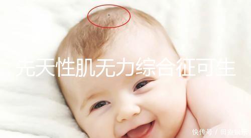 先天性肌無力綜合征可生育嗎？能做試管避免遺傳？