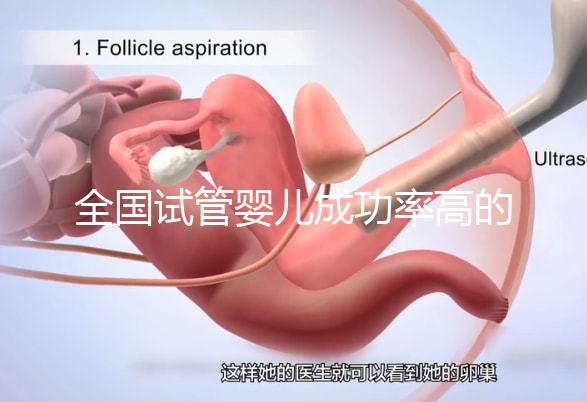 全國試管嬰兒成功率高的醫(yī)院排名，內附2023試管費用及成功率參考