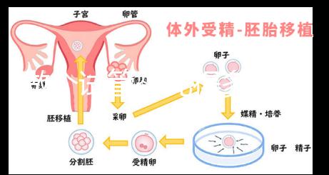 做個(gè)試管嬰兒得多少錢