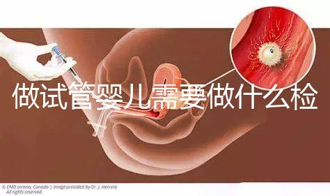 做試管嬰兒需要做什么檢查(做試管嬰兒需要做什么檢查?)
