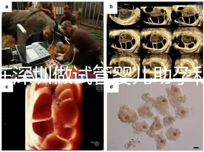 在深圳做試管嬰兒助孕私人機構(gòu)收費標(biāo)準是怎樣的