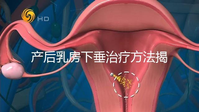 產(chǎn)后乳房下垂治療方法揭秘,按摩手法再好也沒提前預(yù)防有用