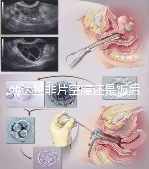 他達(dá)拉非片空腹還是飯后吃看這,控制好用藥時間效果佳