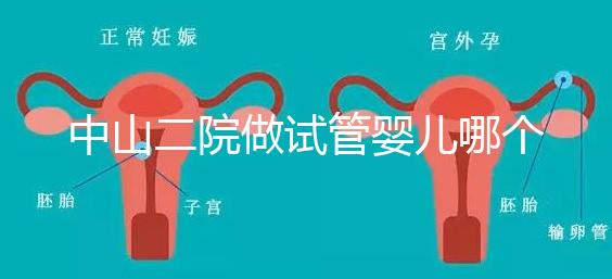 中山二院做試管嬰兒哪個(gè)醫(yī)生好？附醫(yī)院試管成功率