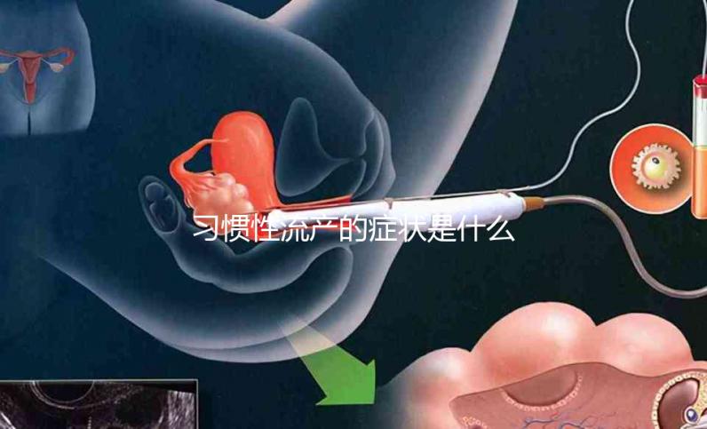 習慣性流產(chǎn)的癥狀是什么?