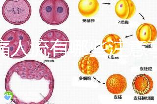 無痛人流有哪些注意事項？
