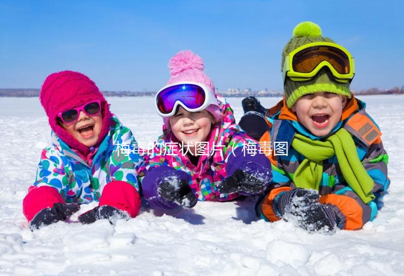 梅毒的癥狀圖片（梅毒圖片男性癥狀圖片）