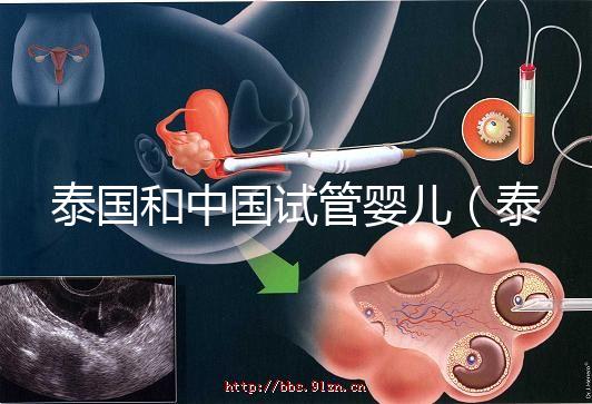 泰國和中國試管嬰兒(泰國和中國試管嬰兒技術(shù)差距)
