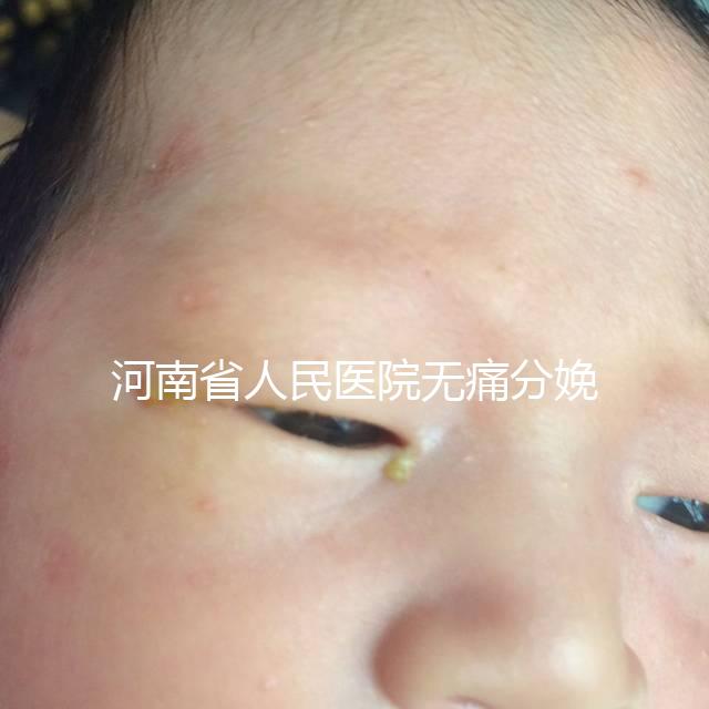 河南省人民醫院無痛分娩多少錢戳，收費標準60s看懂不踩坑