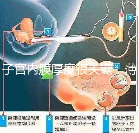 子宮內膜厚度很關鍵，薄了厚了試管嬰兒都難成功