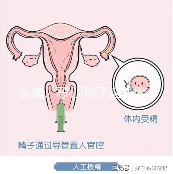 頭痛、惡心!除了這些優思明副作用還有哪些