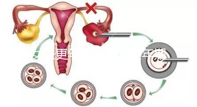 女性更年期保?。ǜ昶趮D女保健健康宣教）