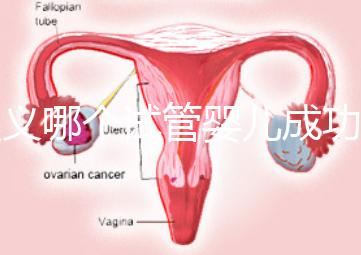 遵義哪個(gè)試管嬰兒成功率高？貴州生殖中心醫(yī)院2024年排名參考