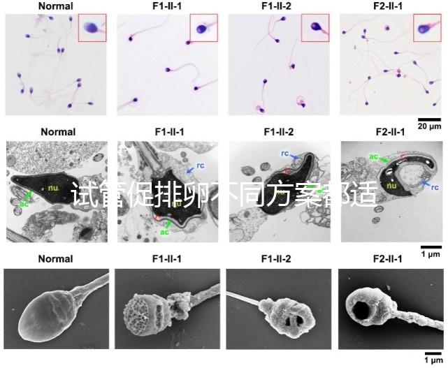 試管促排卵不同方案都適合哪些人？如何監測排卵？