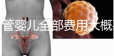 試管嬰兒全部費用大概要多少錢？