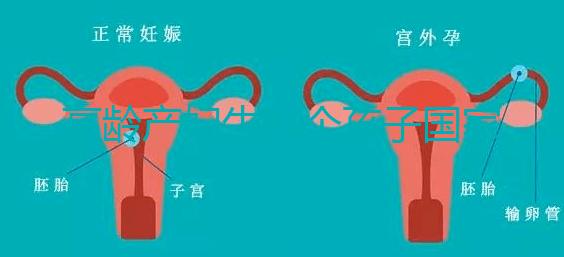 高齡產婦生八個孩子國家有補助?有沒有違法才是關鍵