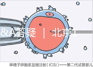 Q&A答疑 | 北京16項(xiàng)輔助生殖技術(shù)進(jìn)醫(yī)保,試管可以報(bào)銷(xiāo)嗎?