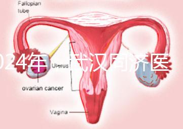 2024年,武漢同濟醫院不孕癥醫生排名公布,選擇專家迅速登記