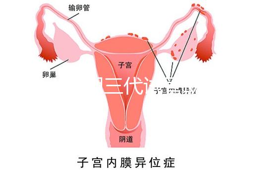 2025昆明三代試管助孕費用一覽，8-15萬元，價格透明公開自主選擇